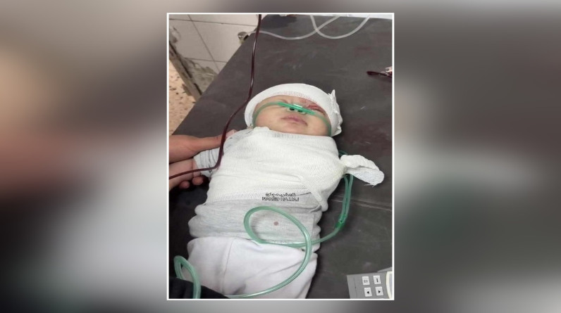 استشهاد الرضيعة شام بعد بتر يدها بقصف على الشجاعية